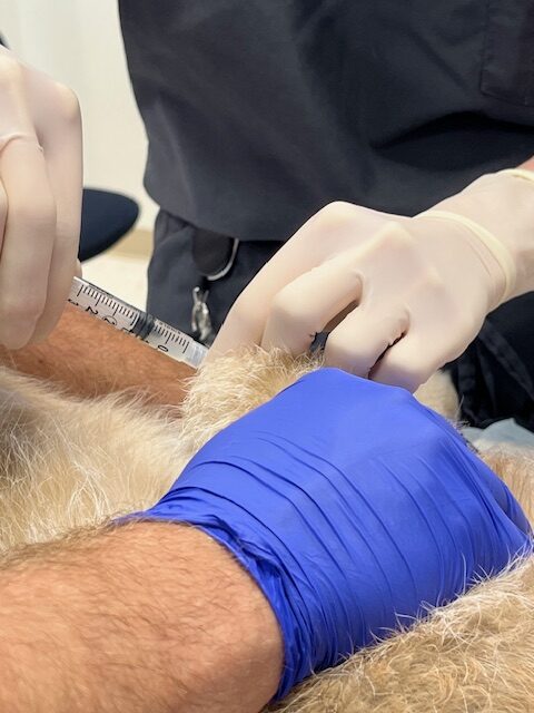 close-up-of-PRP-injection